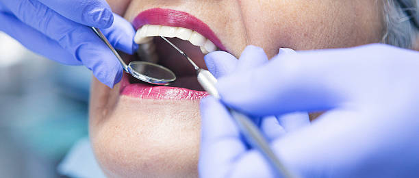 Best Emergency Treatment for Dental Infections or Abscesses in Crane, MO